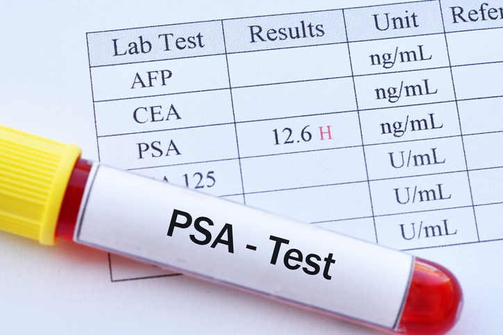 High PSA = Prostate Cancer? Maybe, maybe not