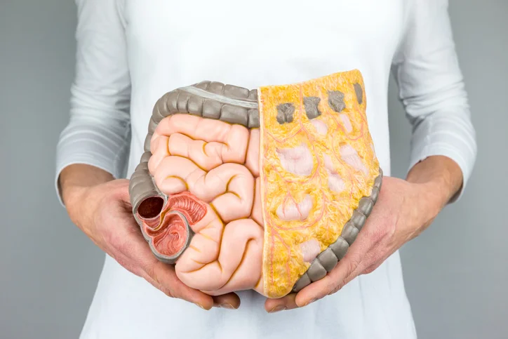 6 tips to reduce your risk of colorectal cancer 