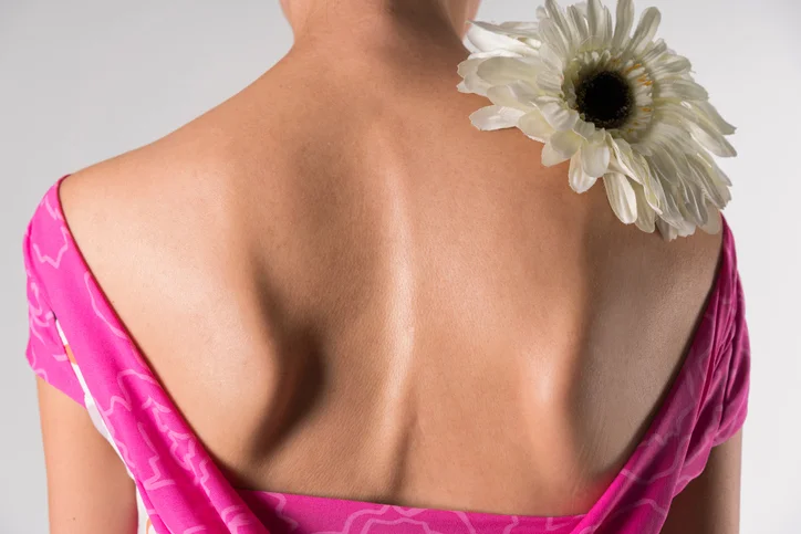 What you should know about adult scoliosis