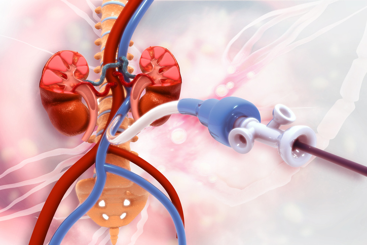 Peripheral Artery Disease: Facts you need to know