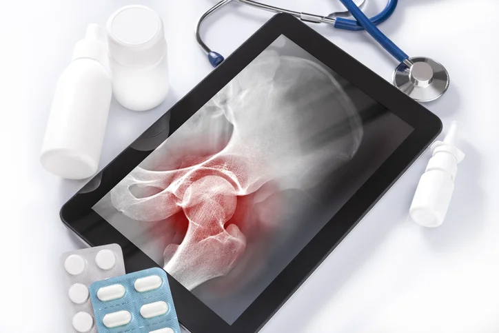 How to tell if you’ve broken a bone
