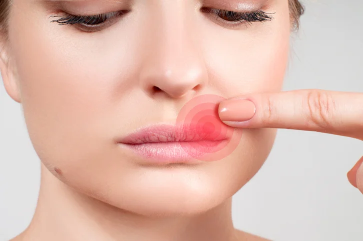 10 common myths about herpes, busted 