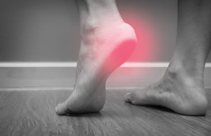 Do your heels hurt? It might be plantar fasciitis 