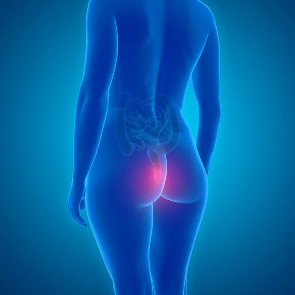 Help for when hemorrhoids become a problem