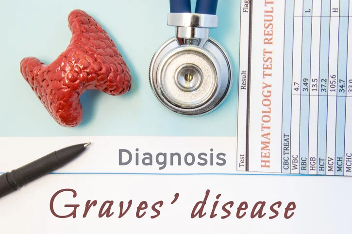 Graves’ disease – a common form of hyperthyroidism