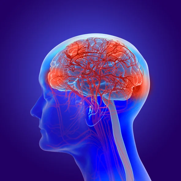 3d illustration of the human brain with alzheimer’s disease - dementia