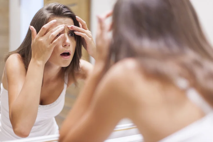 10 major reasons making adult acne worse