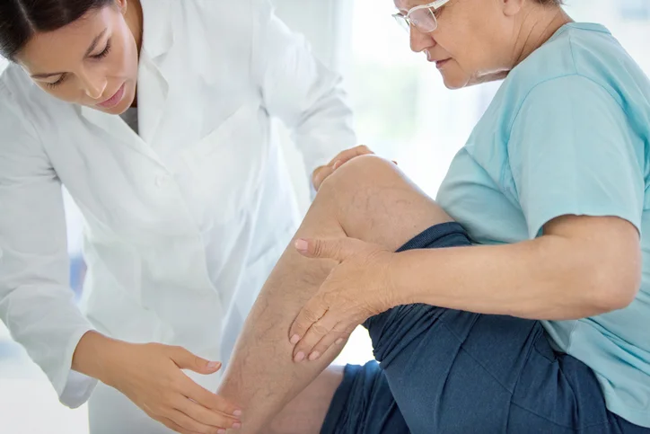 Best advice for varicose vein pain relief