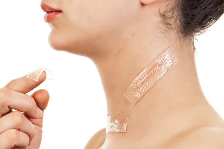Remedies for improving appearance of scars