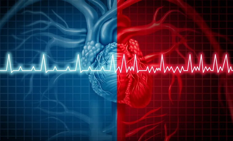 Is it okay to exercise with atrial fibrillation?