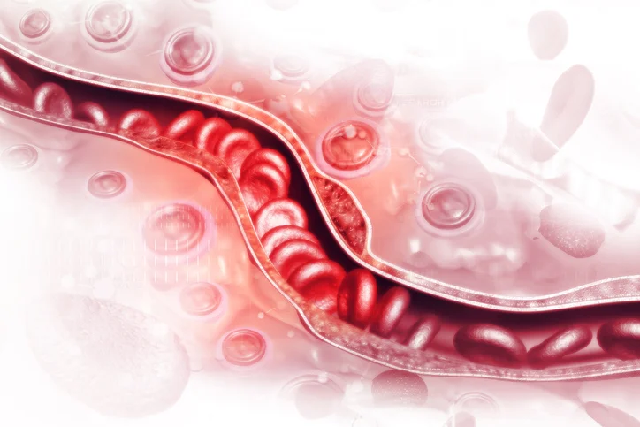 What to know about cancer and blood clots