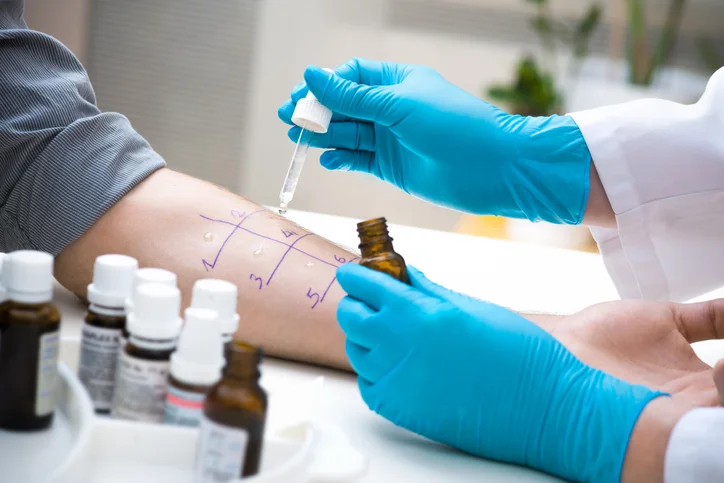 What to expect from allergy skin testing 