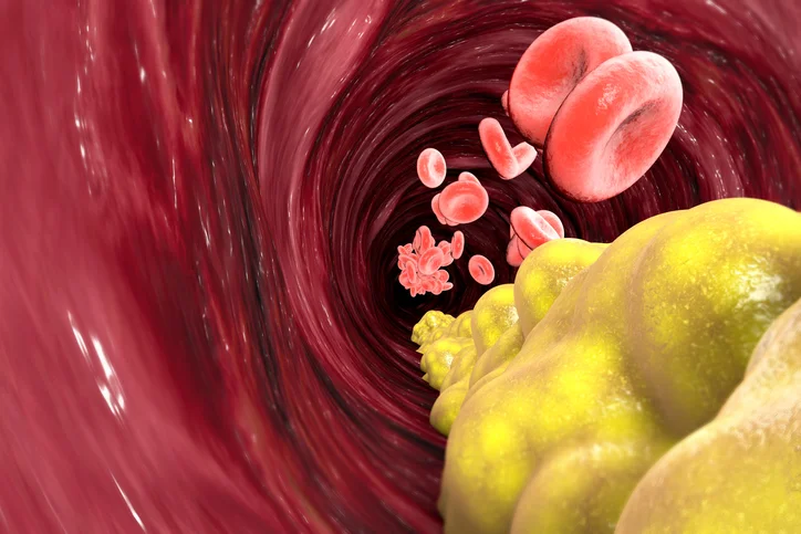 Best ways to raise “good” HDL cholesterol