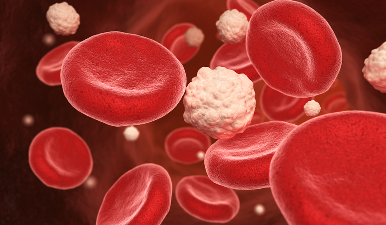 6 Best exercises improving cholesterol