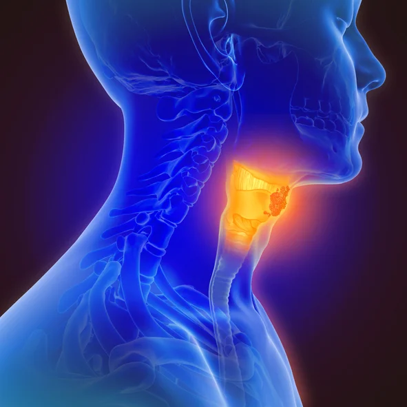 Distinguishing Hashimoto’s disease from hypothyroidism 