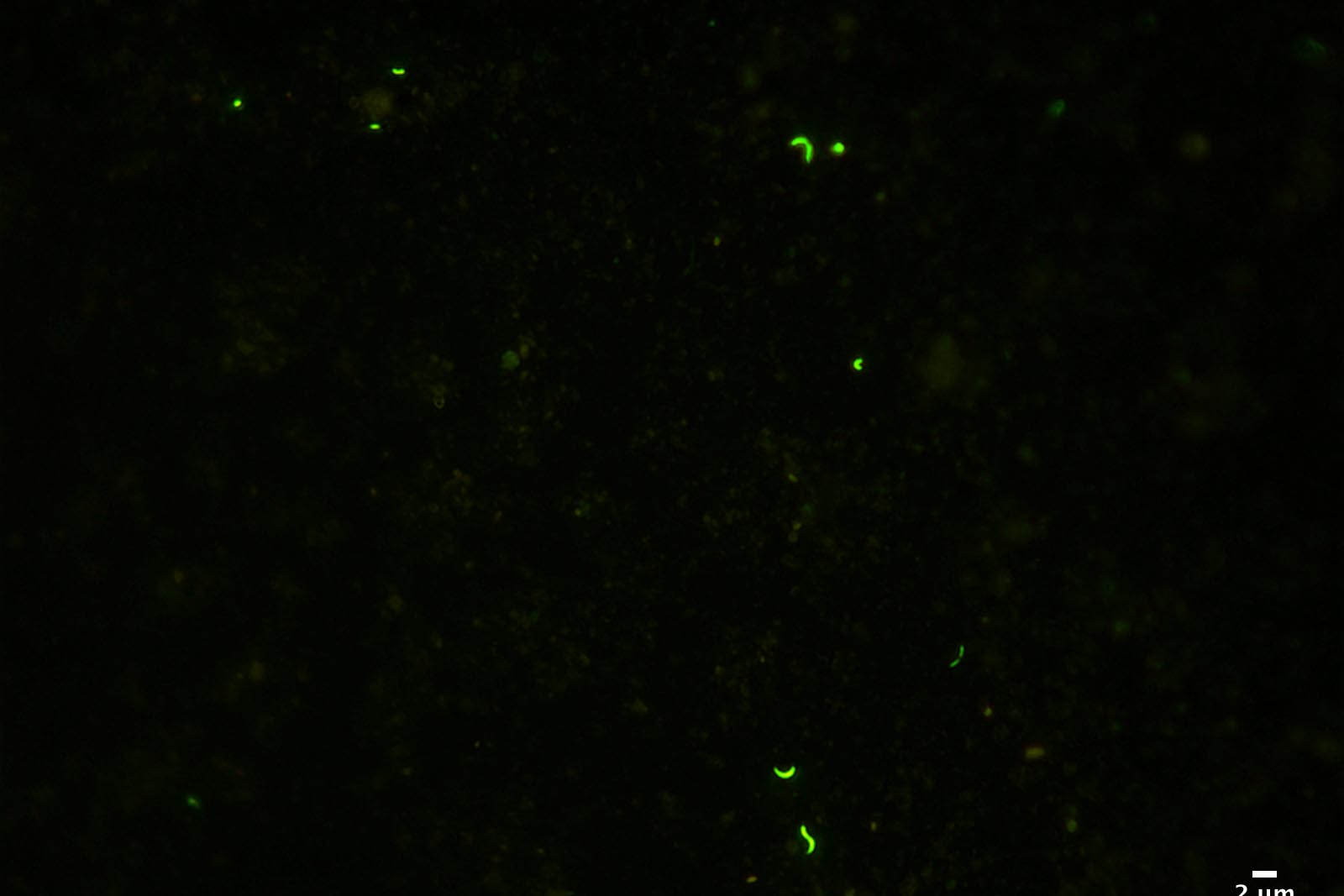 Microbes from Subglacial Lake Whillans. PHOTO BY TRISTA VICK-MAJORS