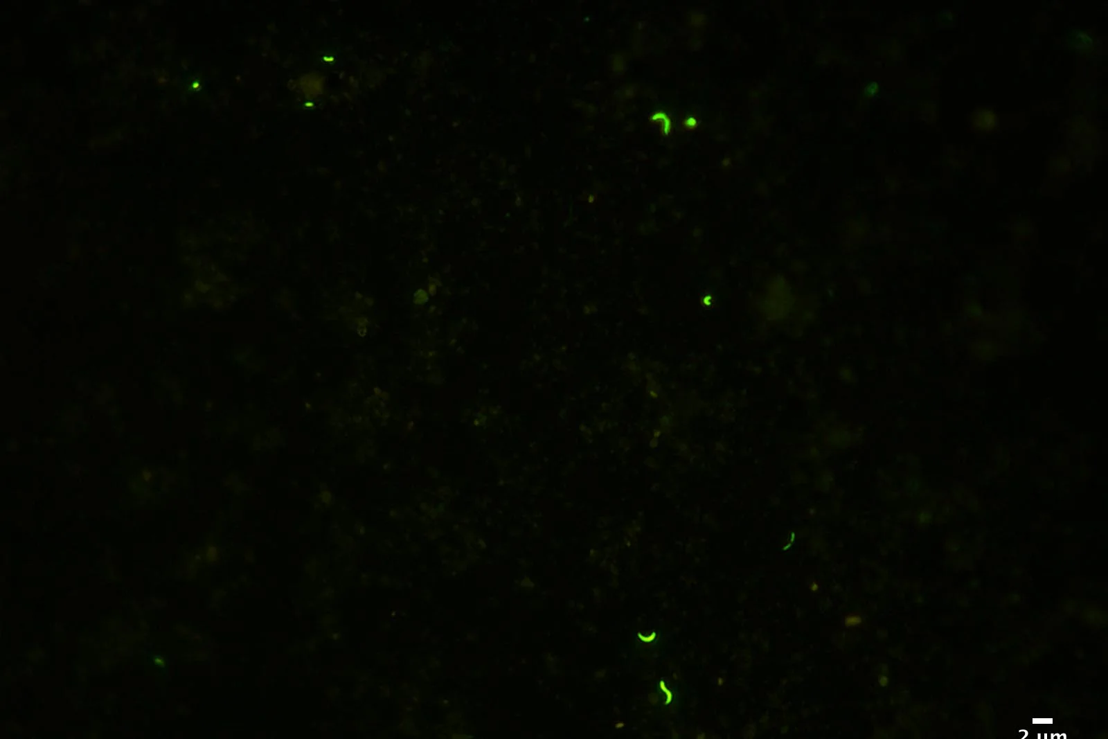 Cells from Subglacial Lake Whillans, fluorescing under the microscope. Photo by Trista Vick-Majors