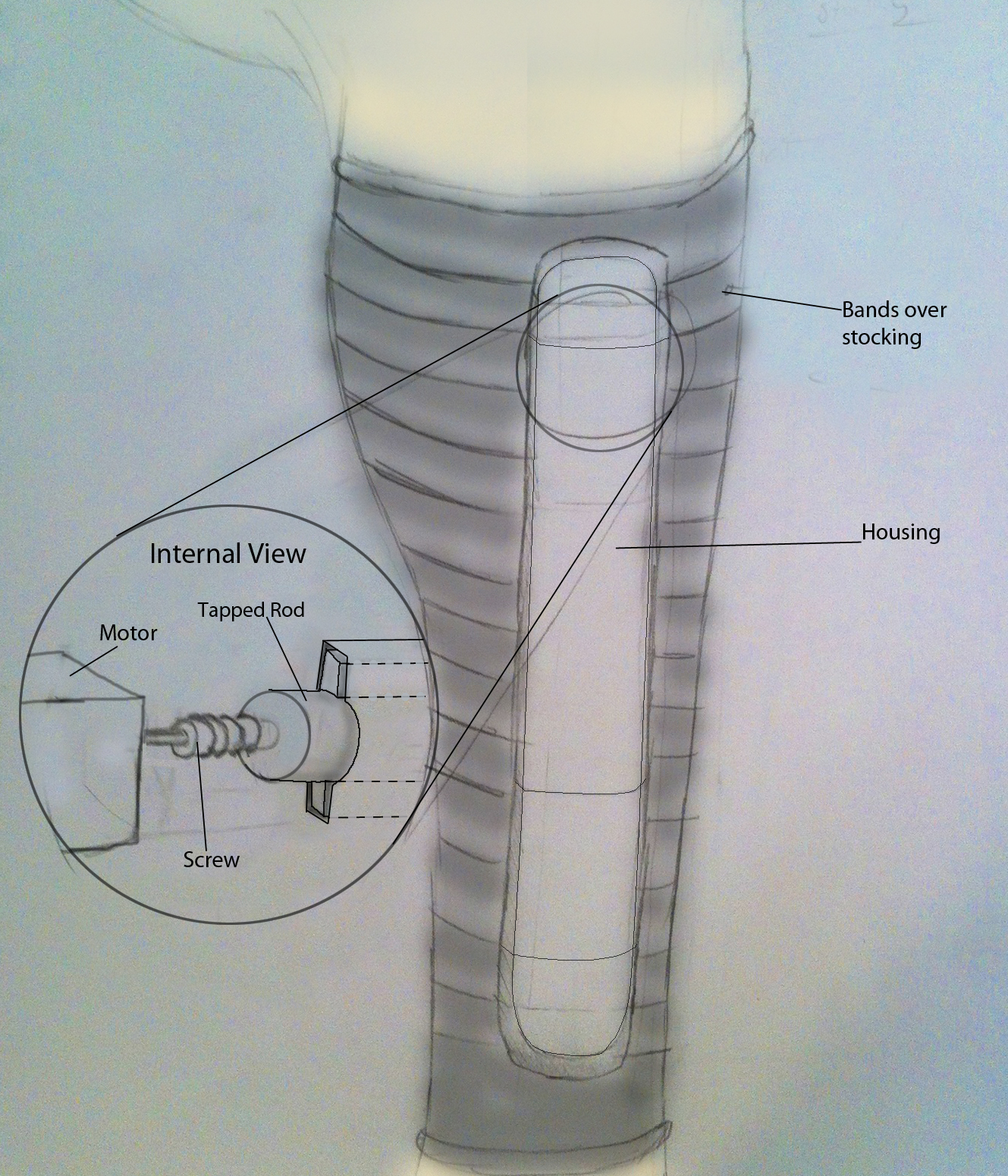 Varicoza injecții. Recommended Posts