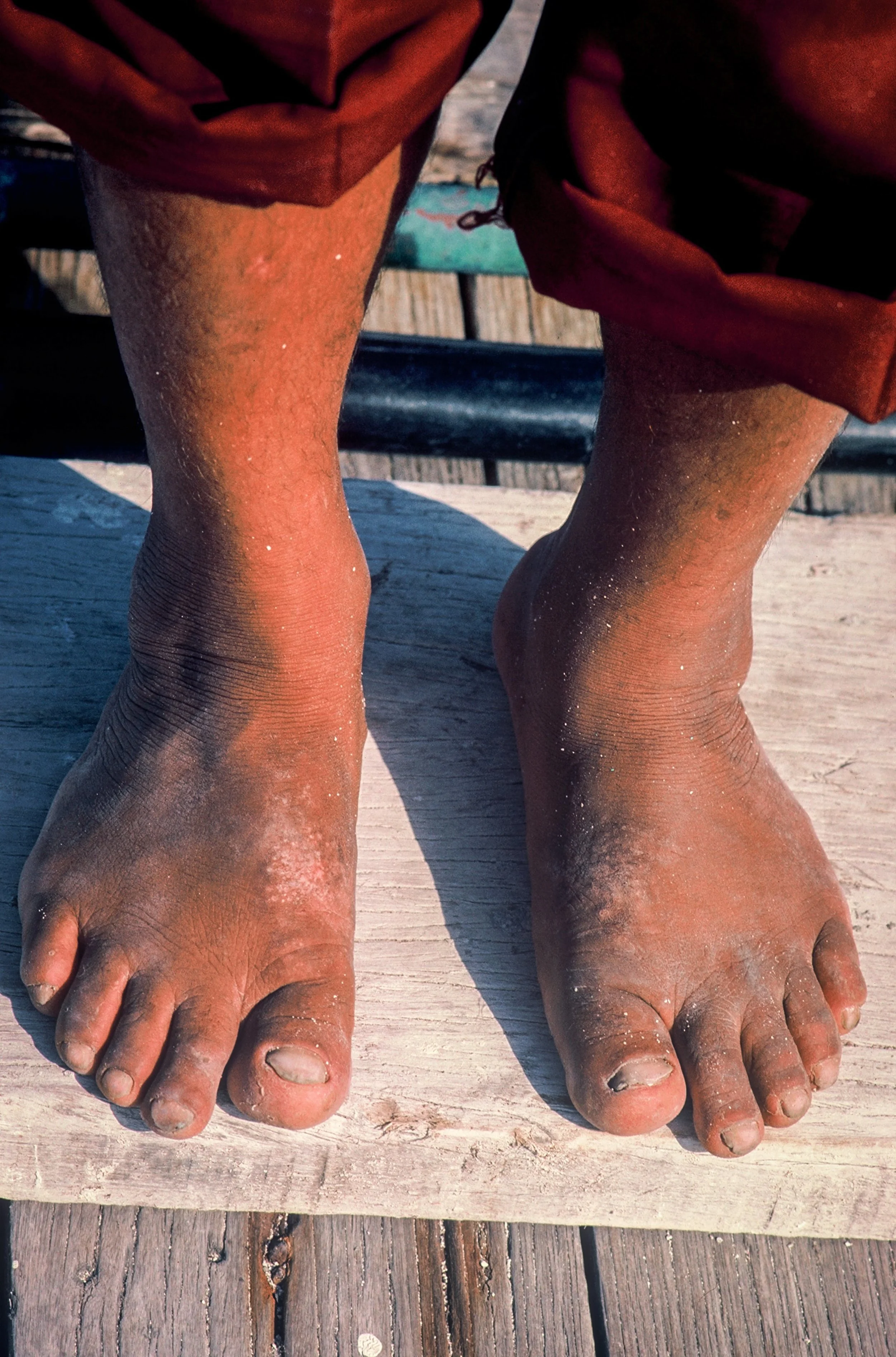 What a foot