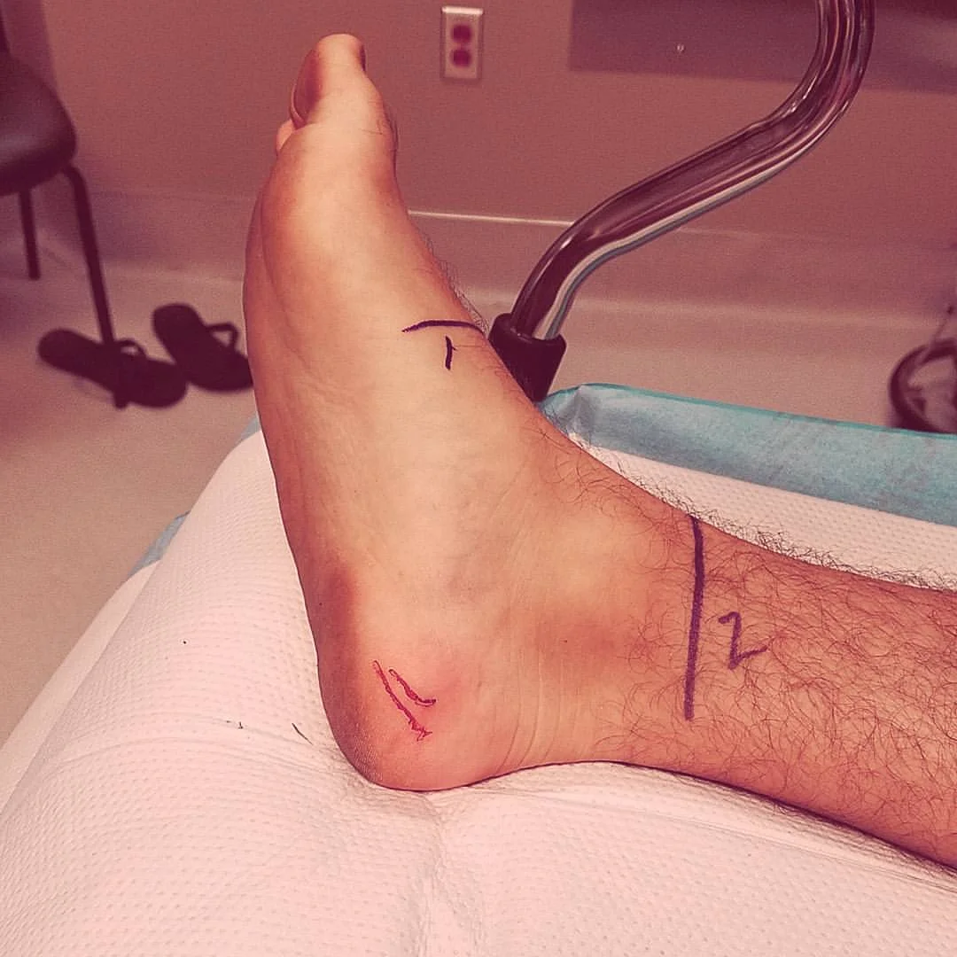 Where the snake got my heel
