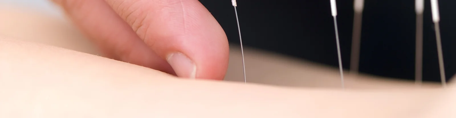 bigstock-acupuncture-12557702.jpg