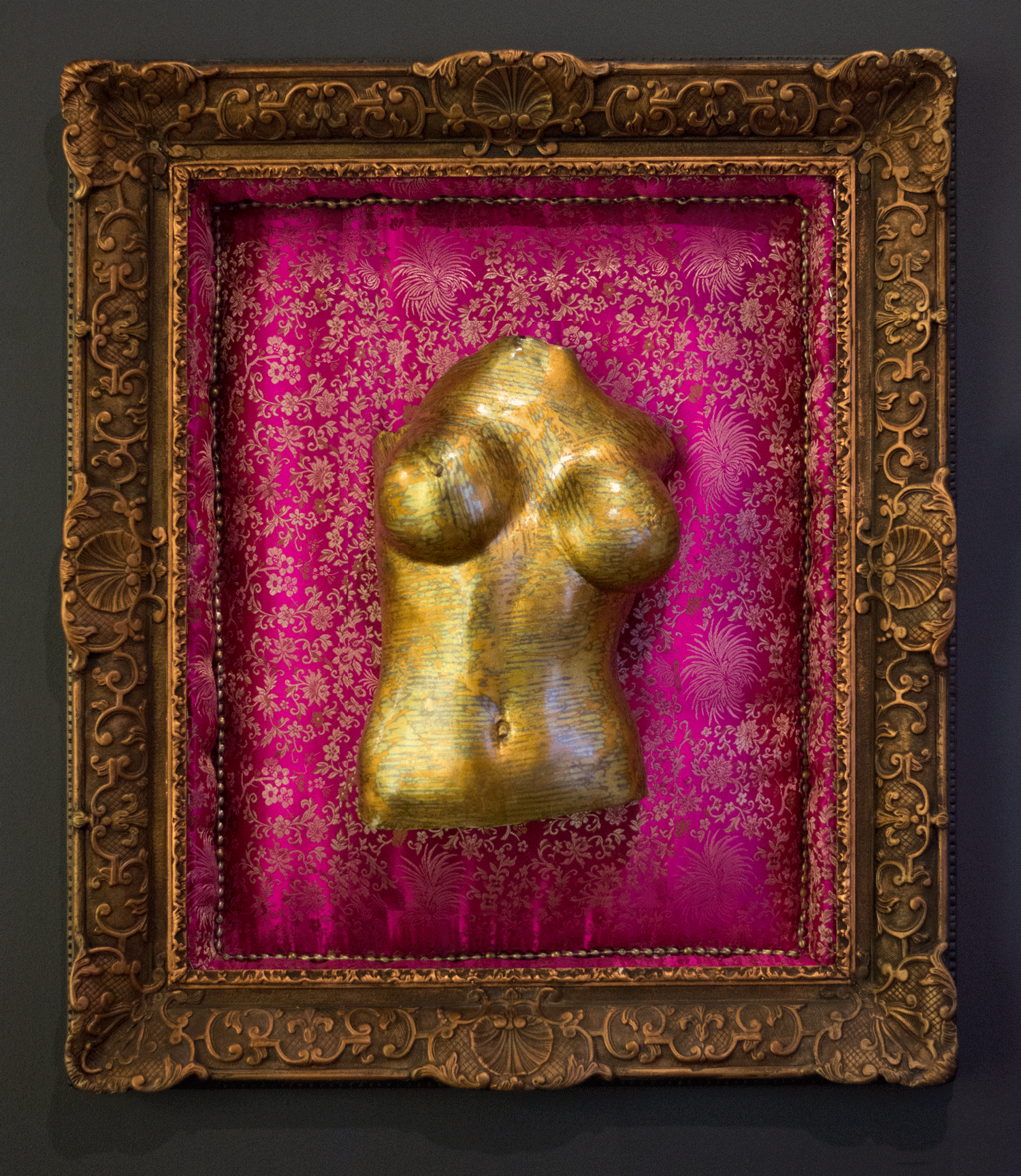 "Mia" Bodycast with Frame