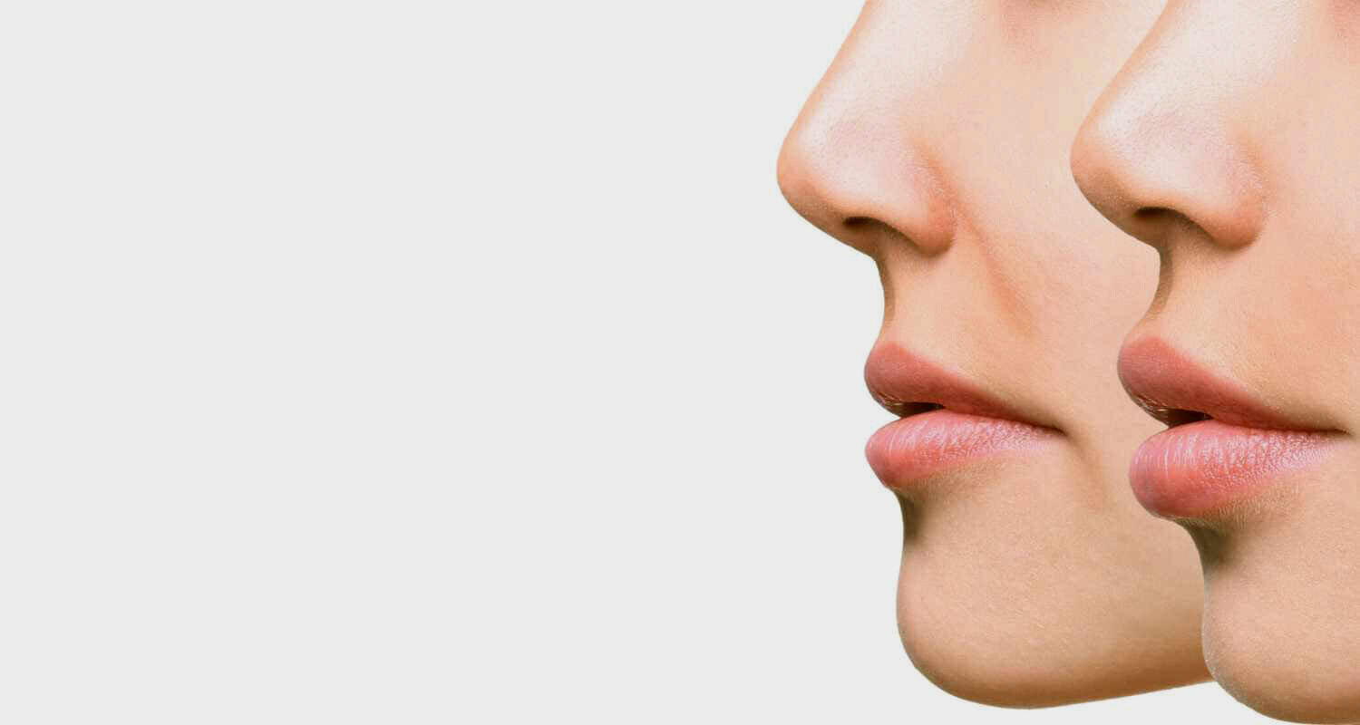   Dermal Fillers   Lip Injections  Youthful Cheeks and Mouth   208-367-0700    Schedule Online  