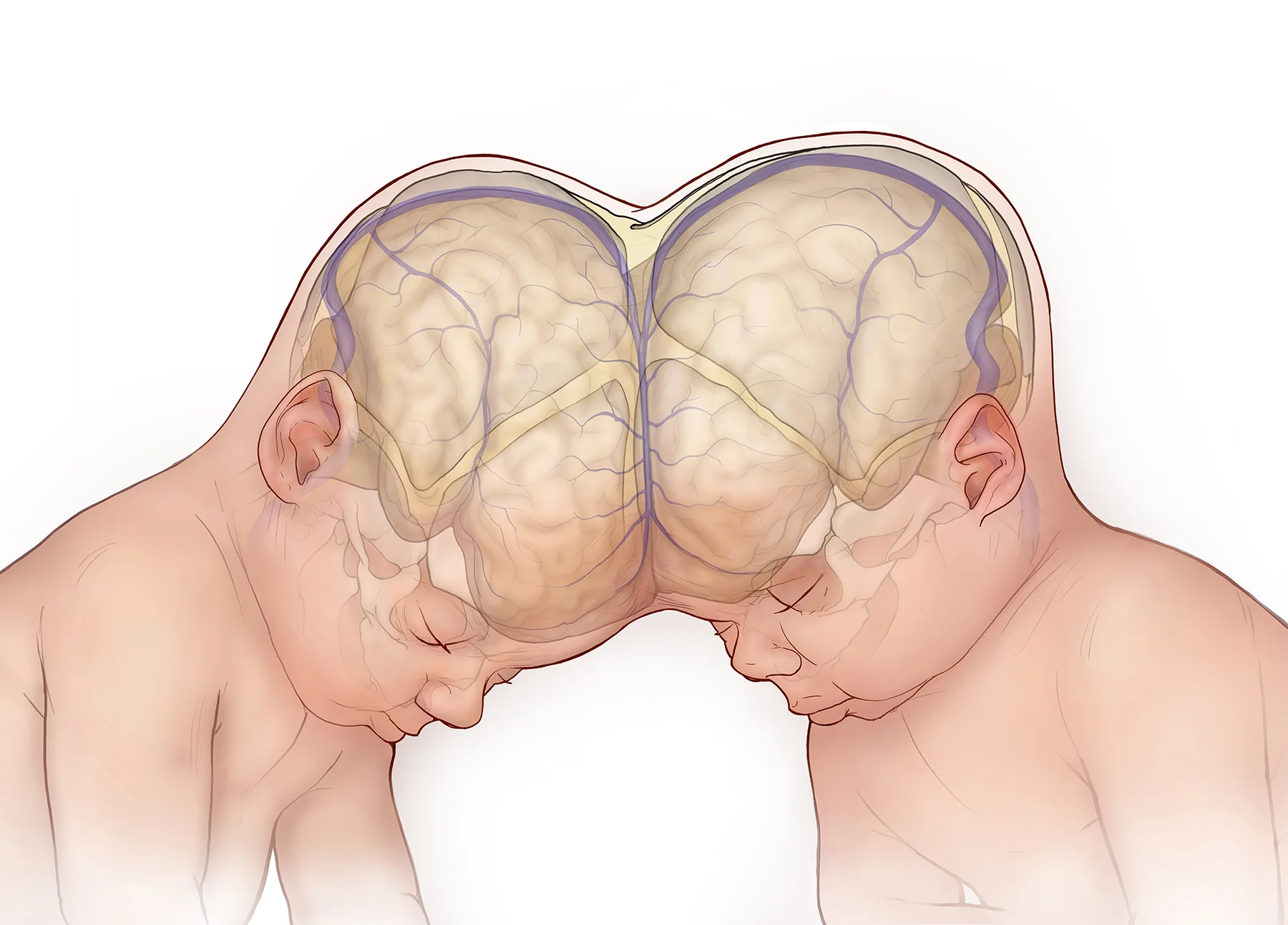 Twins no device.jpg