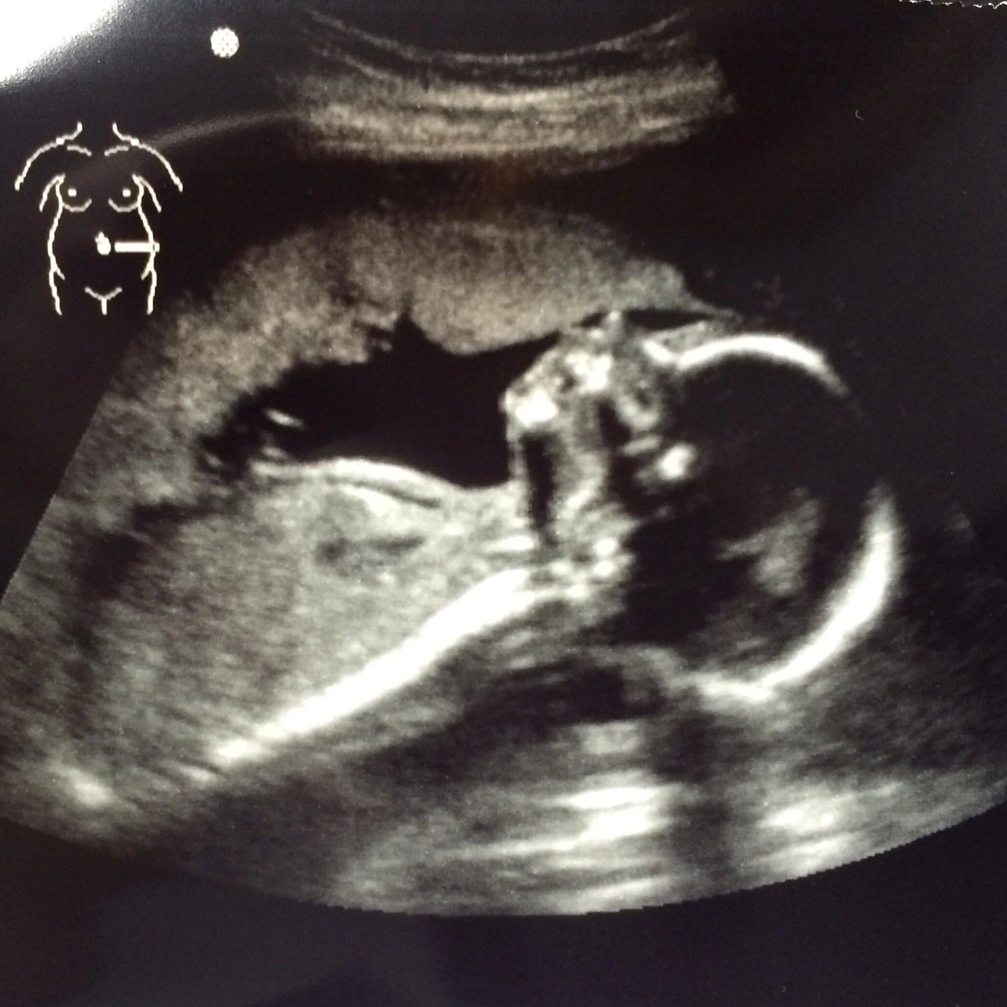 Why This is the Only Image I'll Post of my Daughter