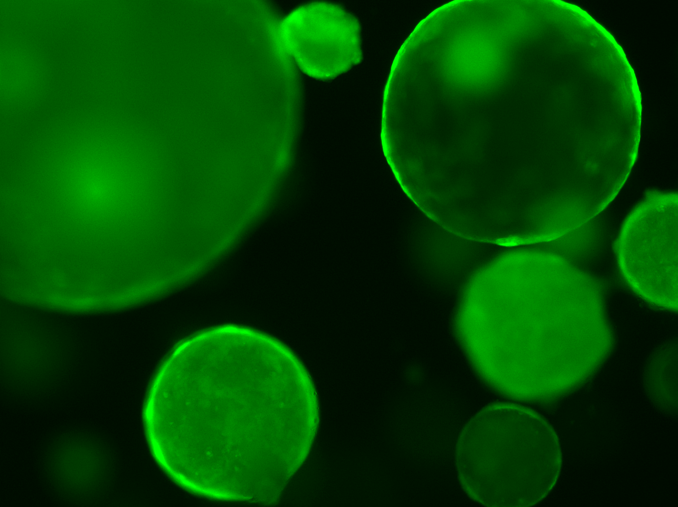 shAPC_organoids.png