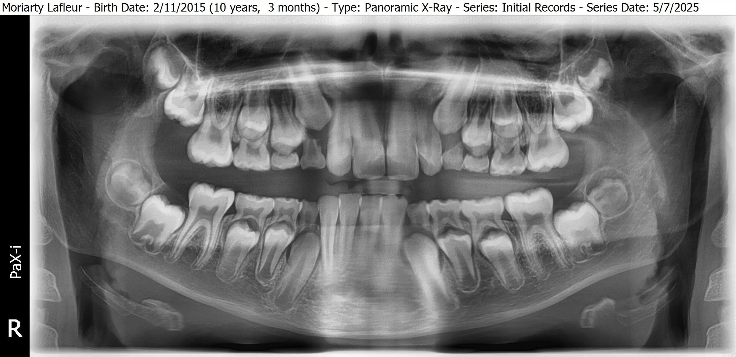 Moriarty Lafleur - 22 - Panoramic X-Ray.JPG