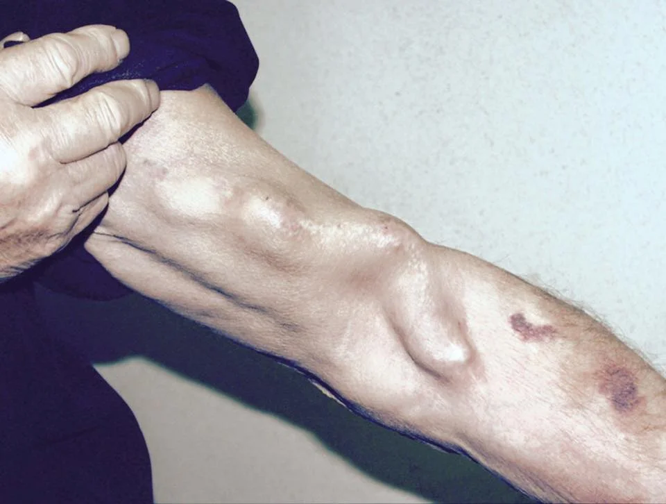 Healed A Man at Penn Station in NYC?