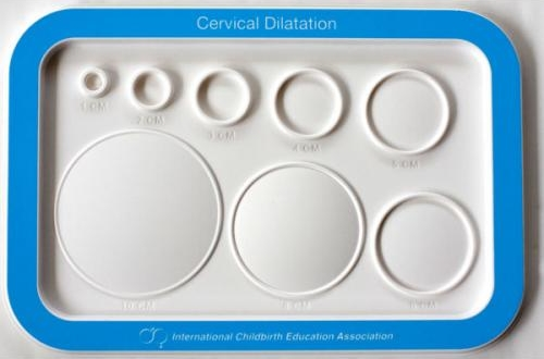cervical_dilation_chart