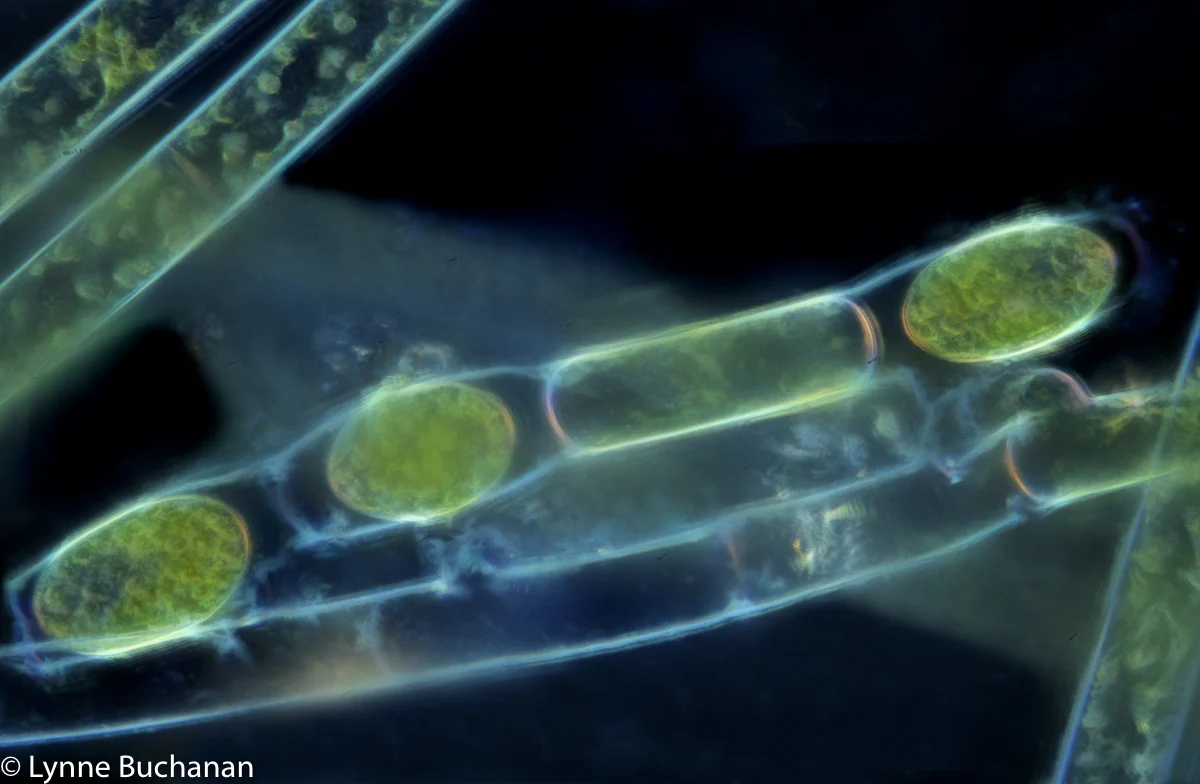 Spirogyra with Zygotes