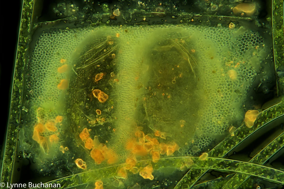 Cladoceran Eggs with Protective Membranes