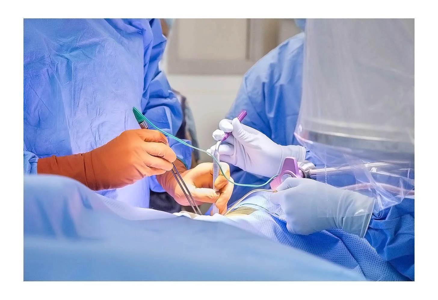 Back Surgery