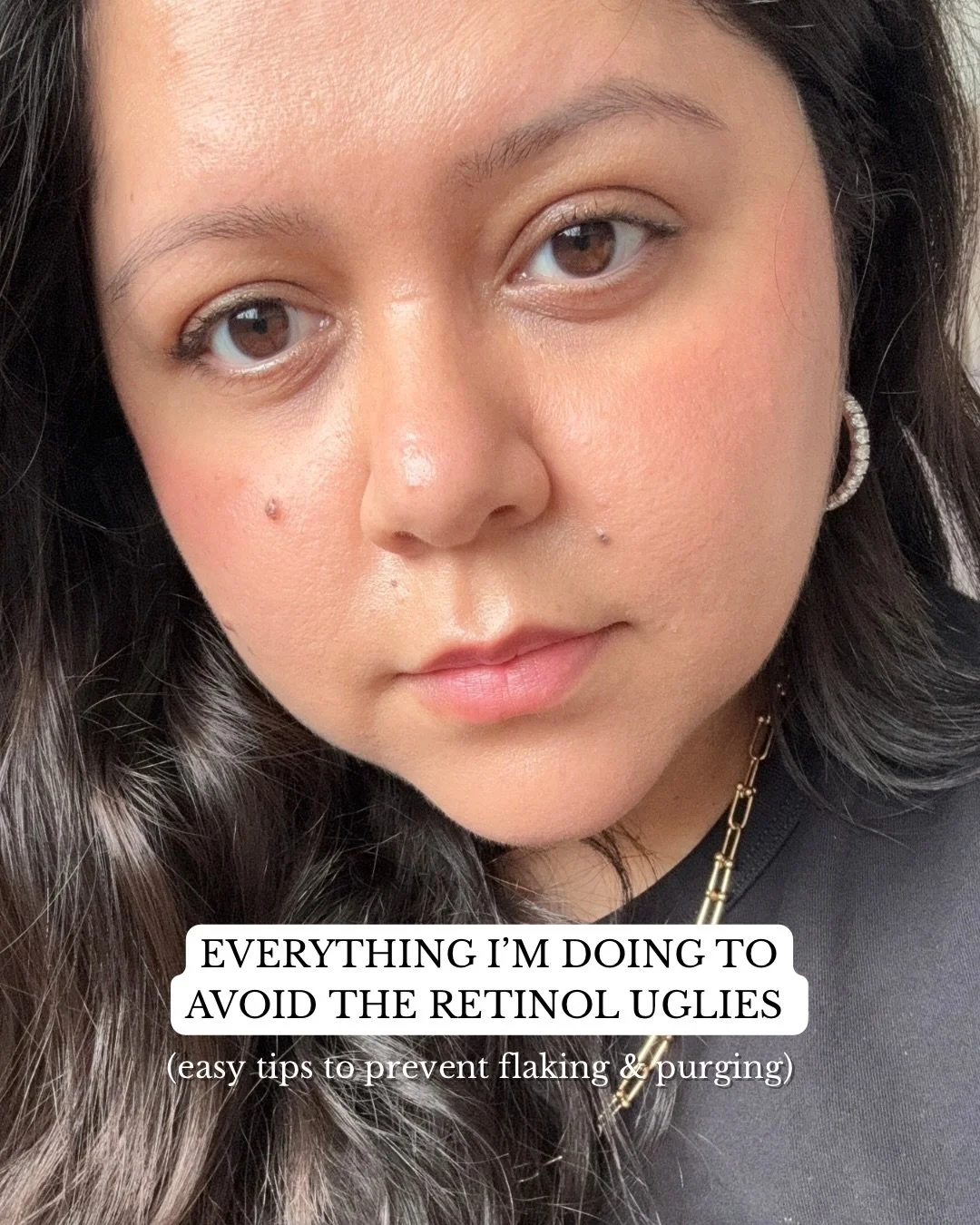 Additional tips below! //👇🏻
&mdash;&mdash;&mdash;
‼️First off, ALWAYS get your dermatologist&rsquo;s approval before starting your retinol journey! If you are pregnant or breastfeeding, this is NOT the time to be using a retinol in your routine

I 