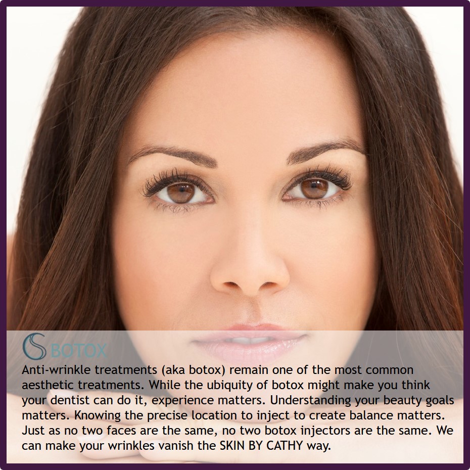 SKIN BY CATHY BOTOX.jpg