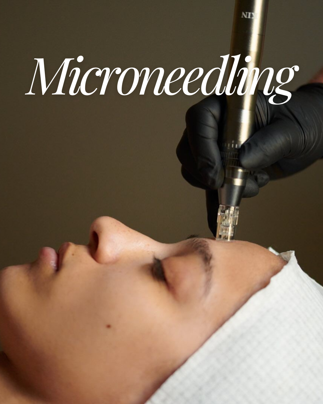 Yuan Spa Adds Microneedling and Nanoneedling Skincare Services