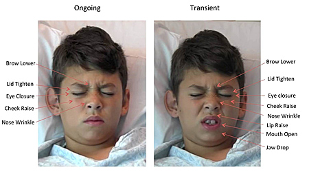 COURTESY UC SAN DIEGO SCHOOL OF MEDICINE
