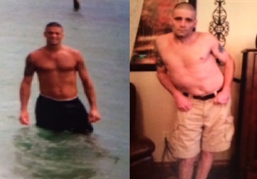 BEFORE AND AFTER PHOTOS OF SHANE SCHWARTZ