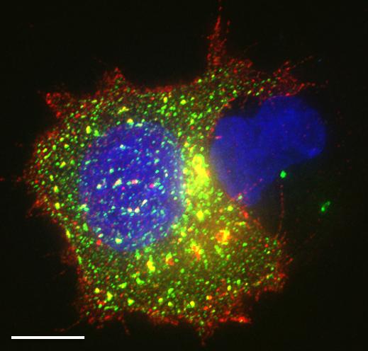 activated immune cells
