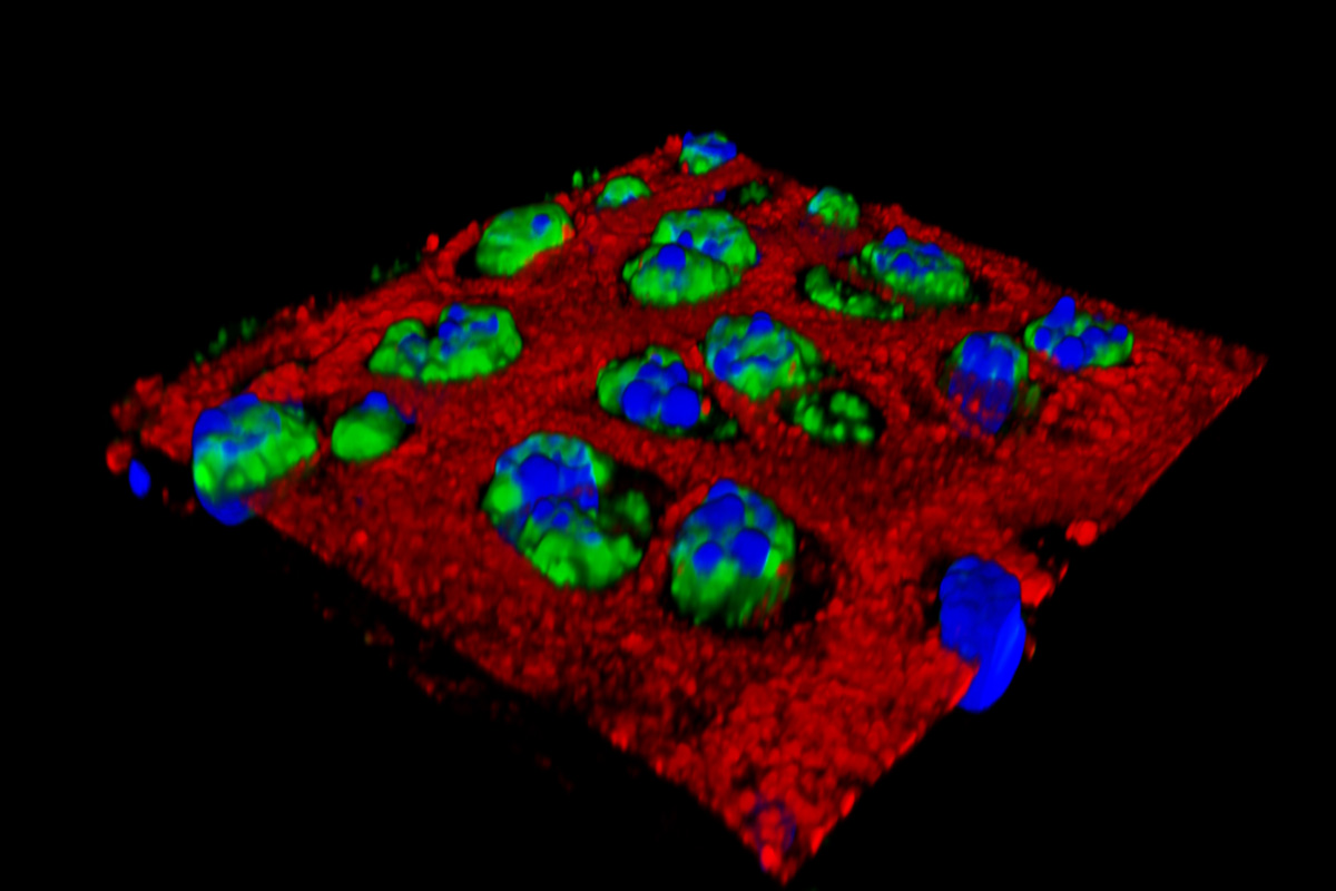 INFLAMMATORY PROTEIN (GREEN) IN CARTILAGE CELLS. IMAGE COURTESY of UNIVERSITY OF WASHINGTON SCHOOL OF MEDICINE