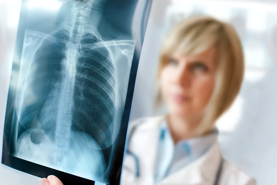bigstock-Female-Doctor-Examining-An-X-r-4997662.jpg