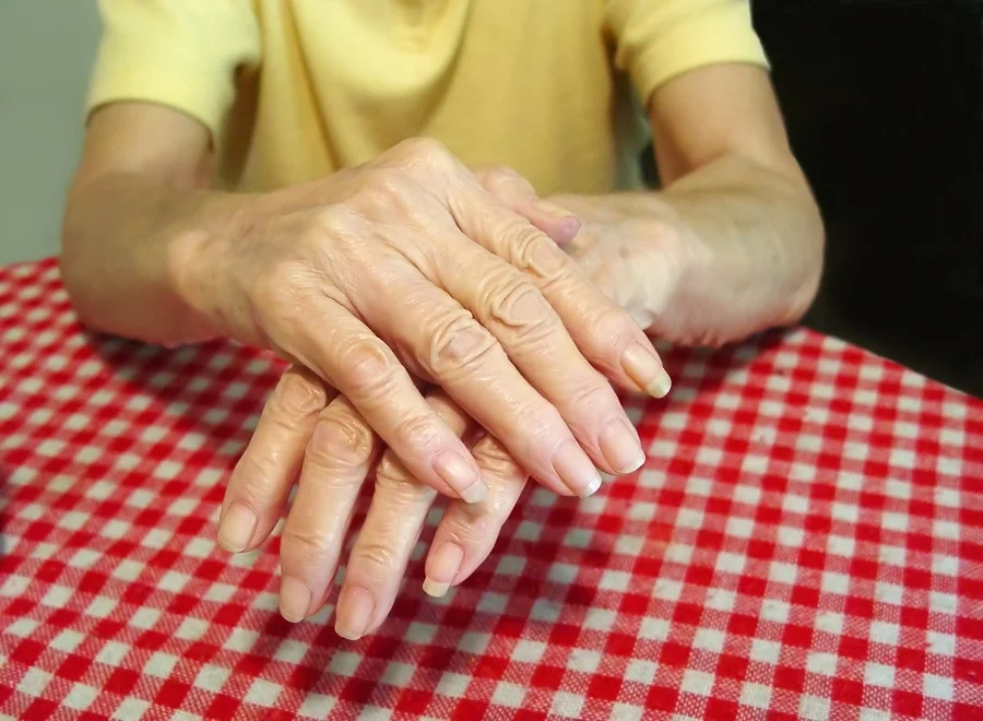 Why Does Menopause Worsen Rheumatoid Arthritis Pain News Network