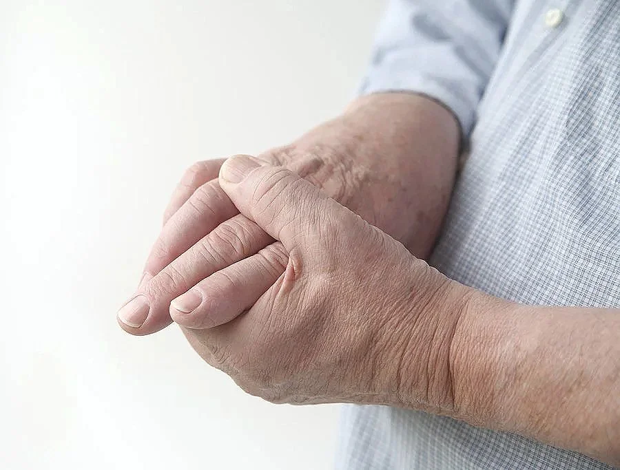 Can Rheumatoid Arthritis Be Prevented?