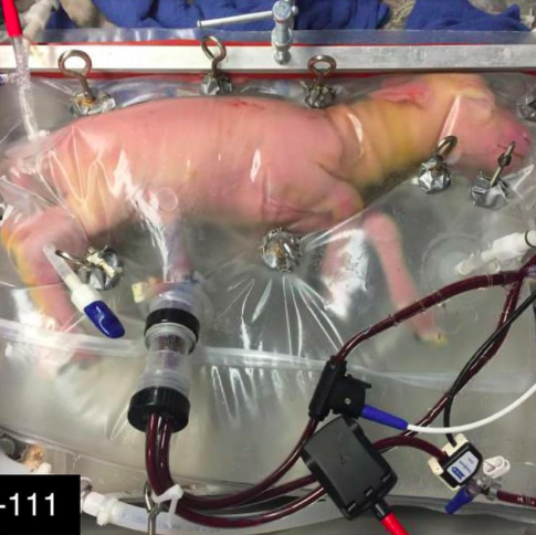 The Body of Motherhood in the Age of the Artificial Uterus
