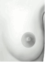 New Breast Cancer Issues