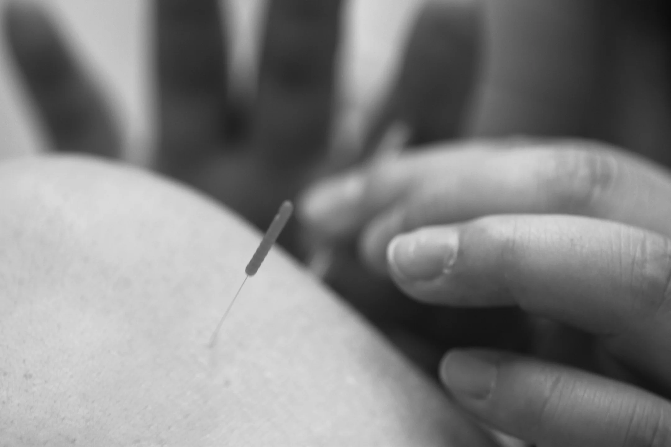 Services-Acupuncture.jpg