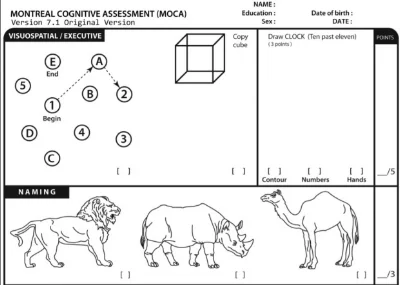 Excerpt from the Montreal Cognitive Assessment.